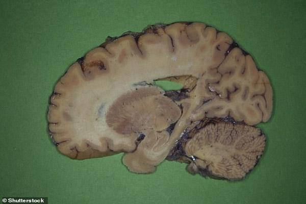 این نوشیدنی عملکرد مغز را تغییر می دهد؟