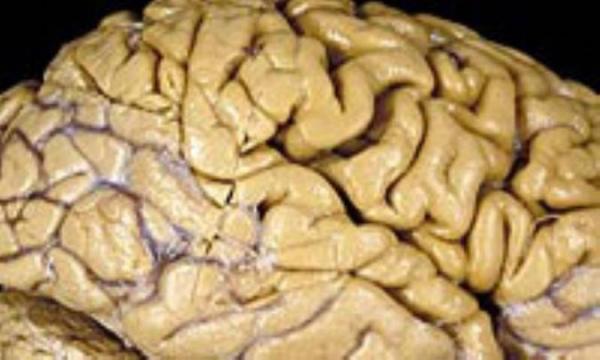 8اشتباه رایج درباره مغز