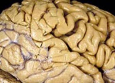 8اشتباه رایج درباره مغز