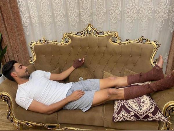 نجات جان همسایه با سوختگی بازیکن داماش همراه شد نجات جان همسایه با سوختگی بازیکن داماش همراه شد